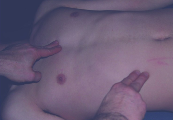 Occipital Fiber Analysis and Soft Tissue Reflex Techniques (CMRT)
